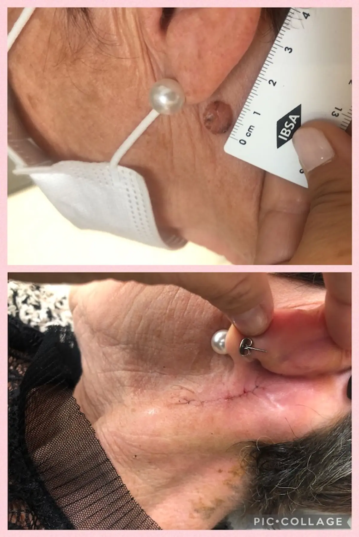 Quando la dermatologia incontra la chirurgia