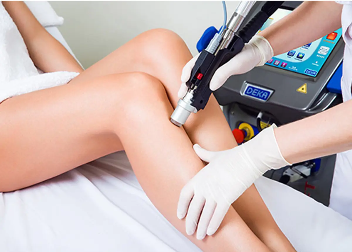 Epilazione medicale con laser Alessandrite